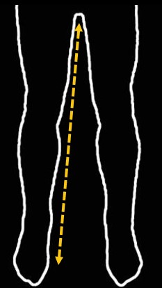 Inside Leg Measurement